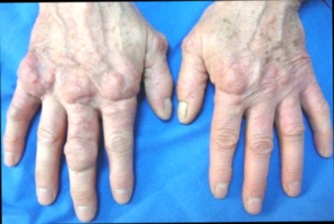 Achat Artimium 360 anti-inflammatoire