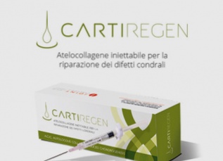 Cartiregen Prix