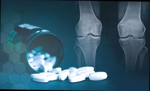 Compléments arthrose Chondraflex