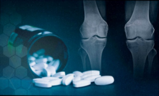 Pommade anti-inflammatoire arthrose Hondro Sol